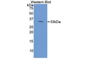 Detection of Recombinant PLA2R1, Human using Polyclonal Antibody to Phospholipase A2 Receptor 1 (PLA2R1) (PLA2R1 抗体  (AA 385-643))