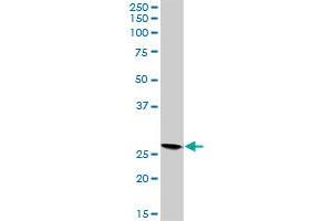 VAPB MaxPab rabbit polyclonal antibody. (VAPB 抗体  (AA 1-243))