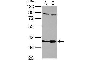 WB Image Sample (30 ug of whole cell lysate) A: Jurkat B: Raji 10% SDS PAGE antibody diluted at 1:1000 (Selenoprotein P 抗体)