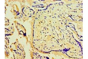 Immunohistochemistry of paraffin-embedded human placenta tissue using ABIN7175707 at dilution of 1:100 (WIPI1 抗体  (AA 187-446))