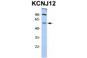 Western Blotting (WB) image for anti-Potassium Inwardly-Rectifying Channel, Subfamily J, Member 12 (KCNJ12) (Middle Region) antibody (ABIN2776235)