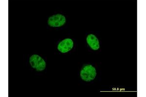 Immunofluorescence of purified MaxPab antibody to KBTBD9 on HeLa cell. (KLHL29 抗体  (AA 1-503))