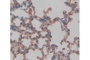 Used in DAB staining on fromalin fixed paraffin- embedded lung tissue (TAP2 抗体  (AA 467-703))