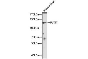 Western blot analysis of extracts of mouse heart, using PLOD1 antibody (ABIN6127271, ABIN6145783, ABIN6145785 and ABIN6218262) at 1:1000 dilution. (PLOD1 抗体  (AA 488-727))