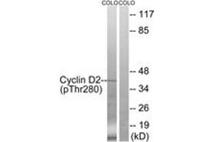 Western blot analysis of extracts from COLO205 cells treated with EGF 200ng/ml 30', using Cyclin D2 (Phospho-Thr280) Antibody. (Cyclin D2 抗体  (pThr280))