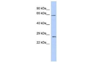 Claudin 18 antibody used at 1 ug/ml to detect target protein. (Claudin 18 抗体  (Middle Region))