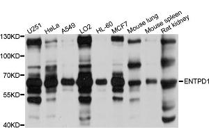 Western blot analysis of extracts of various cell lines, using ENTPD1 antibody (ABIN5971962) at 1/1000 dilution. (CD39 抗体)
