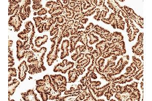 Immunohistochemistry analysis using Rabbit Anti-Wnt5a Polyclonal Antibody (ABIN5651119).