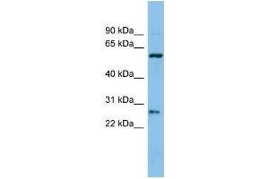 WB Suggested Anti-CTRB1 Antibody Titration: 0. (CTRB1 抗体  (Middle Region))