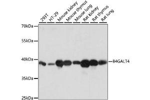 Western blot analysis of extracts of various cell lines, using B4GALT4 antibody. (B4GALT4 抗体)