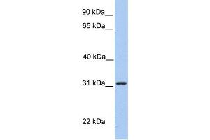 SRPRB antibody used at 1 ug/ml to detect target protein. (SRPRB 抗体  (Middle Region))