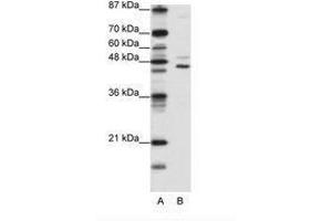 Image no. 1 for anti-Jumonji Domain Containing 4 (JMJD4) (C-Term) antibody (ABIN6736176) (JMJD4 抗体  (C-Term))
