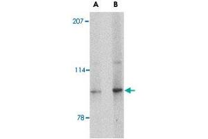 Western blot analysis of SLITRK4 in mouse brain tissue lysate with SLITRK4 polyclonal antibody  at (A) 0. (SLITRK4 抗体  (C-Term))