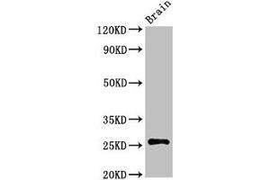 Western Blot Positive WB detected in: Rat brain tissue All lanes: ASCL1 antibody at 3 μg/mL Secondary Goat polyclonal to rabbit IgG at 1/50000 dilution Predicted band size: 26 kDa Observed band size: 26 kDa (ASCL1 抗体  (AA 1-236))