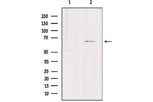 Western blot analysis of extracts from rat brain, using SLC7A4 Antibody. (SLC7A4 抗体  (C-Term))