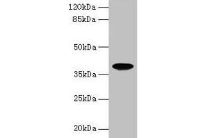 Western blot All lanes: FPR2 antibody at 8 μg/mL + HL60 whole cell lysate Secondary Goat polyclonal to rabbit IgG at 1/10000 dilution Predicted band size: 39 kDa Observed band size: 39 kDa (FPR2 抗体  (AA 307-351))