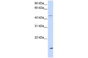 CETP antibody used at 1 ug/ml to detect target protein. (CETP 抗体  (N-Term))
