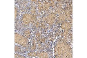 IHC analysis of Cytokeratin 2e/KRT2 using anti-Cytokeratin 2e/KRT2 antibody (ABIN7600644). (Keratin 2 抗体  (AA 213-332))