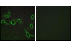Immunofluorescence analysis of COS-7 cells, using HTR7 antibody. (HTR7 抗体  (C-Term))