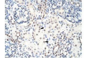 HKR1 antibody was used for immunohistochemistry at a concentration of 4-8 ug/ml to stain Epithelial cells of renal tubule (arrows) in Human Kidney. (HKR1 抗体  (C-Term))