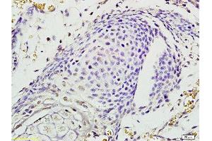 Formalin-fixed and paraffin embedded mouse embryo labeled with Rabbit Anti EphA7/Eph receptor A7 Polyclonal Antibody, Unconjugated  at 1:200 followed by conjugation to the secondary antibody and DAB staining (EPH Receptor A7 抗体  (AA 181-280))