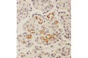 Anti-HOXA3 antibody, IHC(P) IHC(P): Human Pancreatic Cancer Tissue (HOXA3 抗体  (C-Term))