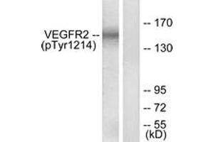 Western blot analysis of extracts from HepG2 cells treated with Na3VO4 0. (VEGFR2/CD309 抗体  (pTyr1214))