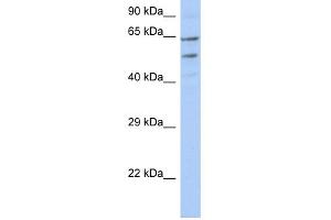 WB Suggested Anti-TMCC3 Antibody Titration:  0. (TMCC3 抗体  (N-Term))