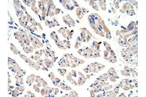 ACO1 antibody was used for immunohistochemistry at a concentration of 12. (Aconitase 1 抗体  (N-Term))