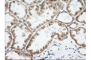 Immunohistochemical staining of paraffin-embedded Human Kidney tissue using anti-LOX mouse monoclonal antibody. (LOX 抗体  (AA 22-168))