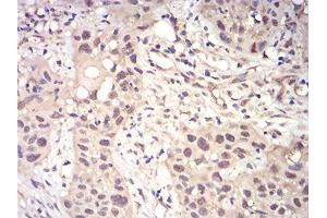 Immunohistochemistry (IHC) image for anti-RAD23 Homolog A (RAD23A) (AA 1-363) antibody (ABIN5542637)