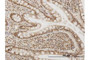 Immunoperoxidase of monoclonal antibody to OXSR1 on formalin-fixed paraffin-embedded human small Intestine. (OXSR1 抗体  (AA 351-450))