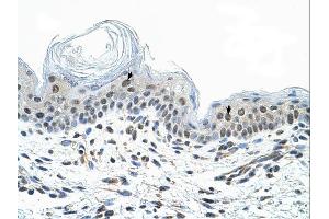 Immunohistochemistry (IHC) image for anti-COP9 Constitutive Photomorphogenic Homolog Subunit 2 (Arabidopsis) (COPS2) (N-Term) antibody (ABIN2780578) (COPS2 抗体  (N-Term))