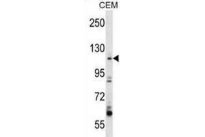 Western Blotting (WB) image for anti-rho Guanine Nucleotide Exchange Factor (GEF) 1 (ARHGEF1) antibody (ABIN2998307) (ARHGEF1 抗体)