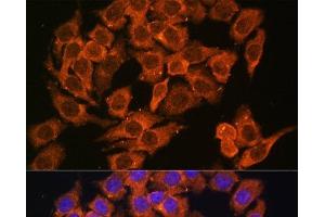 Immunofluorescence analysis of HeLa cells using MYO6 Polyclonal Antibody at dilution of 1:100. (Myosin VI 抗体)