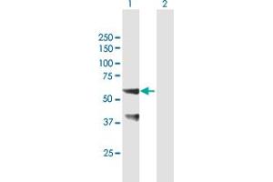 Western Blot analysis of SNX25 expression in transfected 293T cell line by SNX25 MaxPab polyclonal antibody. (SNX25 抗体  (AA 1-483))