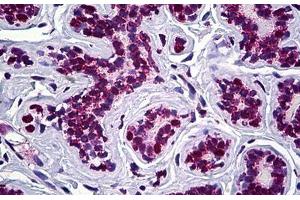Immunohistochemistry (Formalin-fixed Paraffin-embedded Sections) (IHC (fp)) image for anti-Stromal Antigen 2 (STAG2) (AA 1130-1232) antibody (ABIN626087)