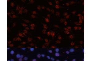 Immunofluorescence analysis of C6 cells using TCF4 Polyclonal Antibody at dilution of 1:100 (40x lens). (TCF4 抗体)