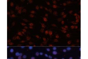 Immunofluorescence analysis of C6 cells using TCF4 Polyclonal Antibody at dilution of 1:100 (40x lens). (TCF4 抗体)