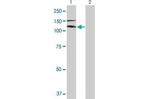 Western Blot analysis of IL17RA expression in transfected 293T cell line by IL17RA MaxPab polyclonal antibody. (IL17RA 抗体  (AA 1-866))