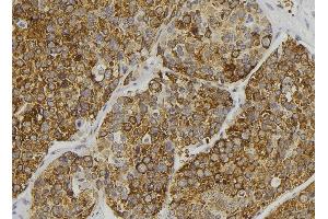 ABIN6279111 at 1/100 staining Human pancreas tissue by IHC-P. (ALMS1 抗体  (C-Term))