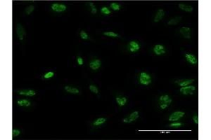 Immunofluorescence of monoclonal antibody to STK32B on HeLa cell. (STK32B 抗体  (AA 314-414))