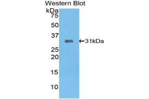Western blot analysis of the recombinant protein. (LIMS1 抗体  (AA 68-303))