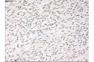 Immunohistochemical staining of paraffin-embedded colon tissue using anti-USP13mouse monoclonal antibody. (USP13 抗体)