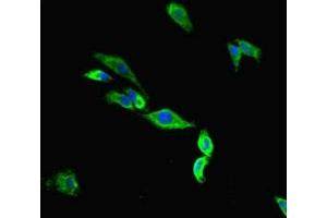 Immunofluorescent analysis of Hela cells using ABIN7172969 at dilution of 1:100 and Alexa Fluor 488-congugated AffiniPure Goat Anti-Rabbit IgG(H+L) (Tmc2 抗体  (AA 6-206))