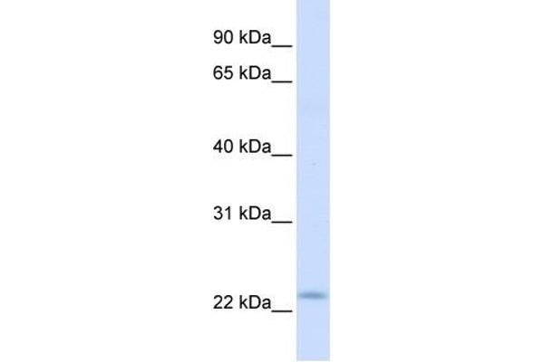 Receptor Accessory Protein 1 抗体  (C-Term)