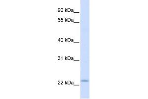 REEP1 antibody used at 1 ug/ml to detect target protein. (Receptor Accessory Protein 1 抗体  (C-Term))