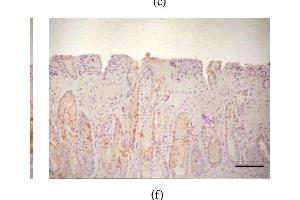 Expression of DAO and ODC in different colonic pathological conditions. (ODC1 抗体  (AA 321-461))