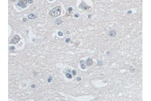 Immunohistochemistry (IHC) image for anti-Small Nuclear Ribonucleoprotein D1 Polypeptide 16kDa (SNRPD1) (AA 1-119) antibody (ABIN7442903)