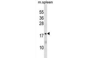 Western Blotting (WB) image for anti-5,10-Methenyltetrahydrofolate Synthetase (5-Formyltetrahydrofolate Cyclo-Ligase) (MTHFS) antibody (ABIN3000360) (MTHFS 抗体)